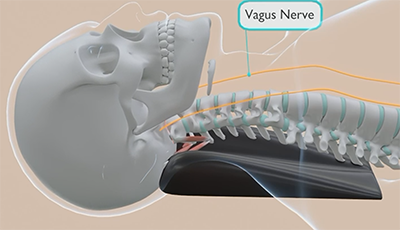 spine aligner neck position xray